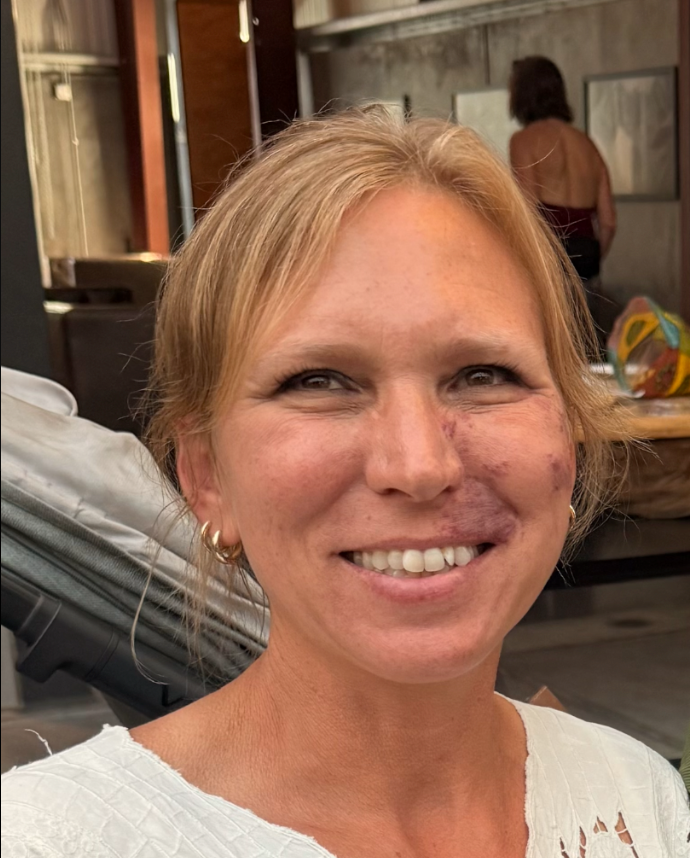 Teacher Stara, Outdoor Education